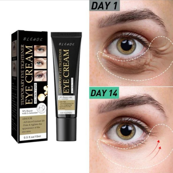 Under-Eye Miracle Cream — See Visible Results in Just Minutes